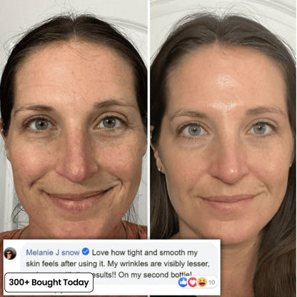 🔥LAST DAY 60% OFF🎁Seurico PDRN Pink Collagen Volume Multi Anti-Aging Balm