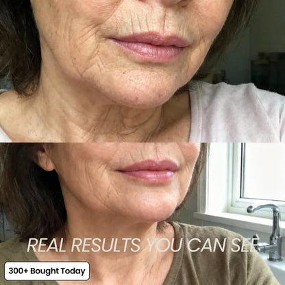 🔥LAST DAY 60% OFF🎁Seurico PDRN Pink Collagen Volume Multi Anti-Aging Balm