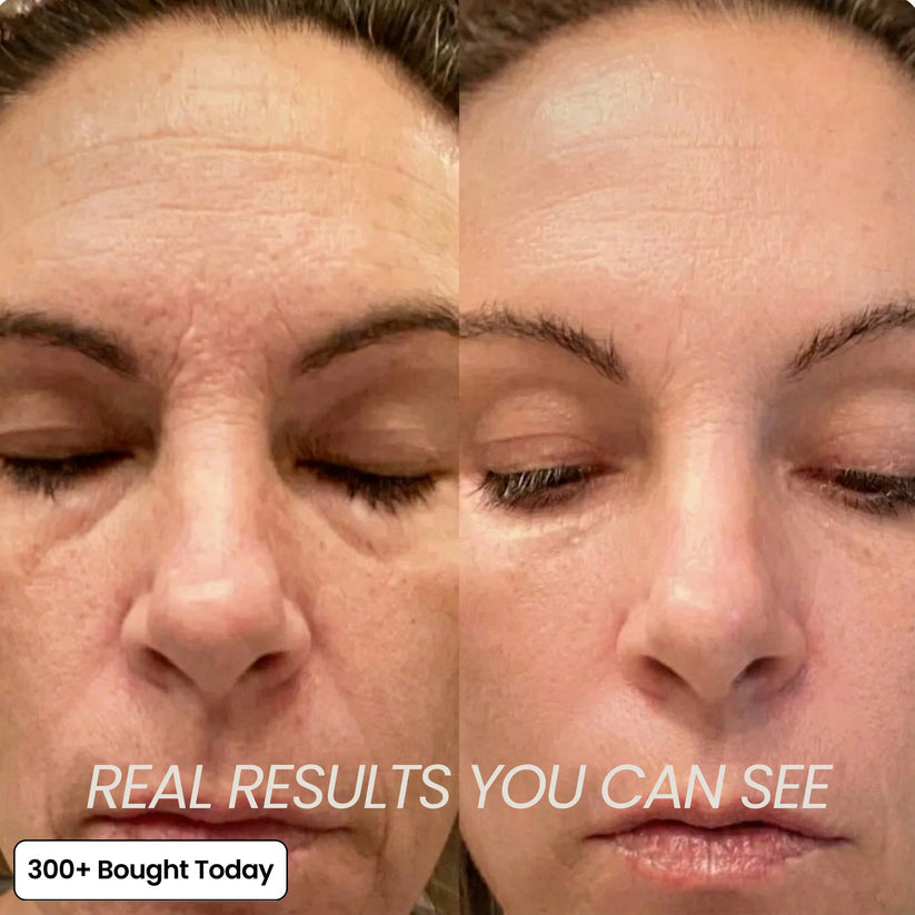 🔥LAST DAY 60% OFF🎁Seurico PDRN Pink Collagen Volume Multi Anti-Aging Balm