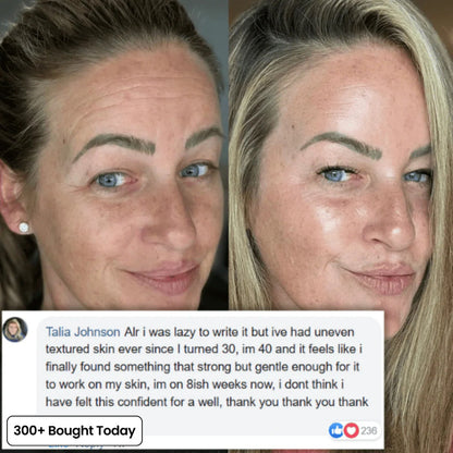 🔥LAST DAY 60% OFF🎁Seurico PDRN Pink Collagen Volume Multi Anti-Aging Balm